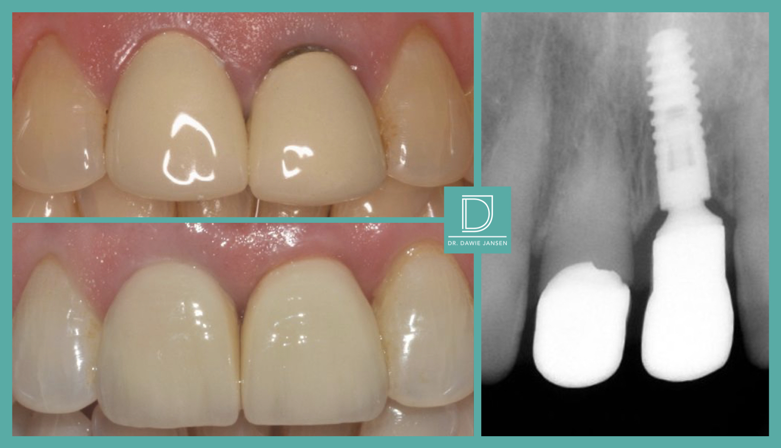 Thurlow Dental Care