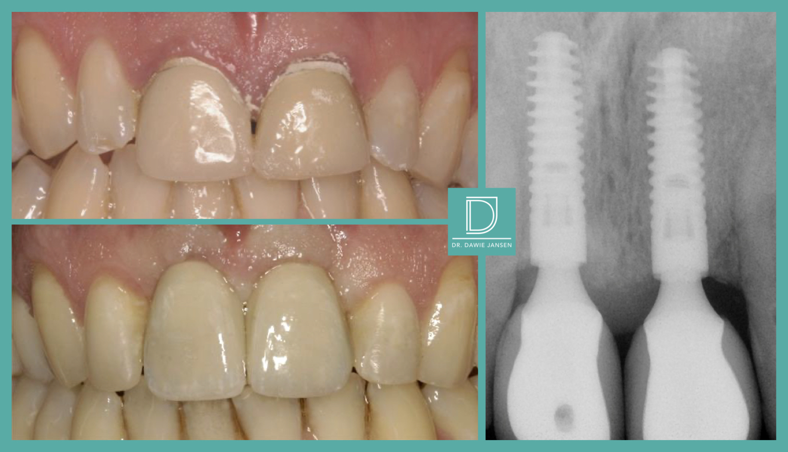 Thurlow Dental Care