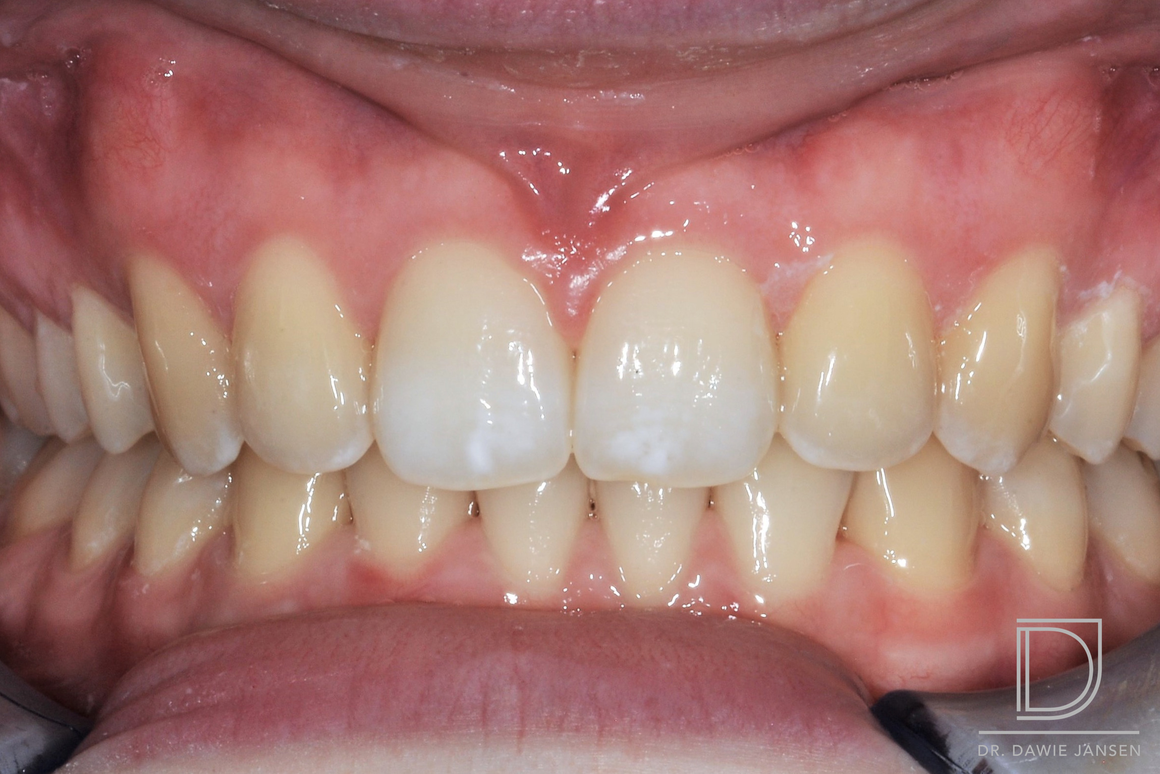 Thurlow Dental Care