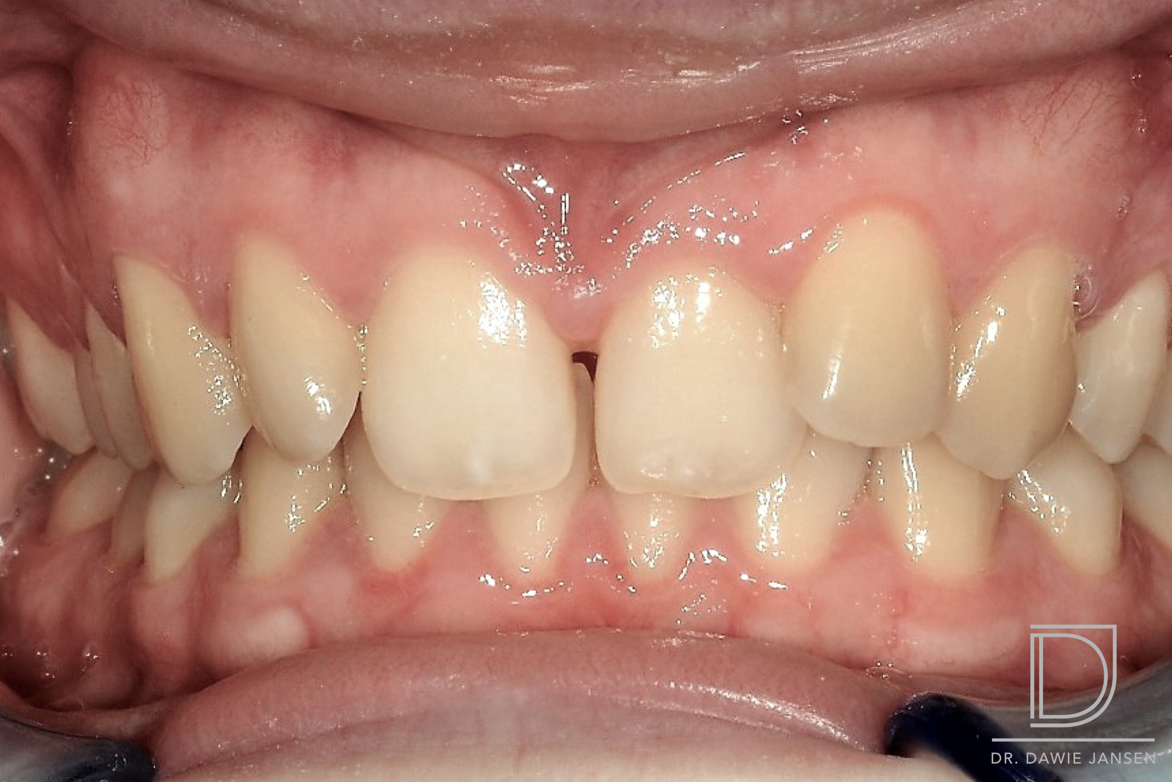 Thurlow Dental Care